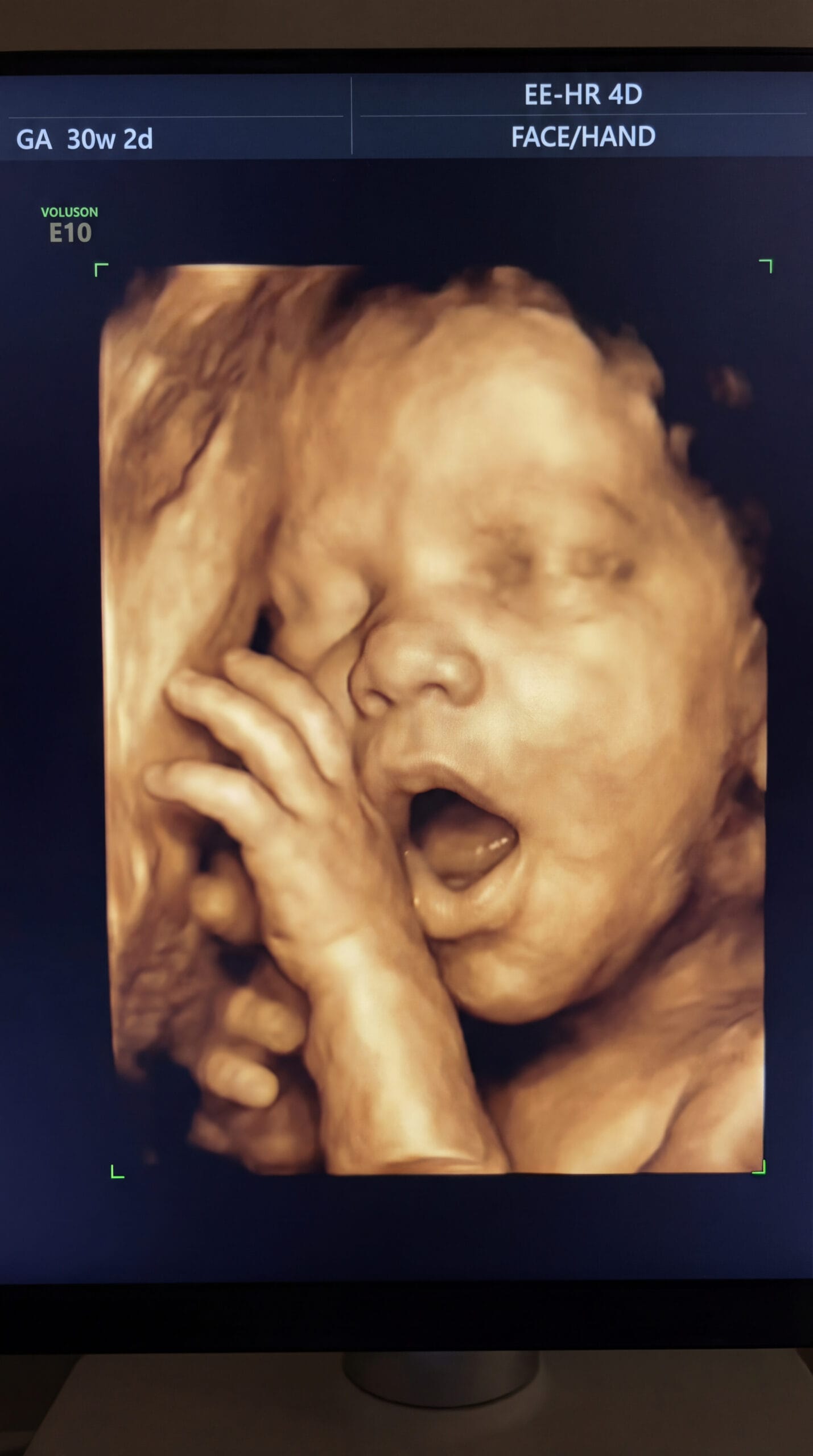 Sadece Bir Fotoğraf Değil, Detaylı Tıbbi Tarama