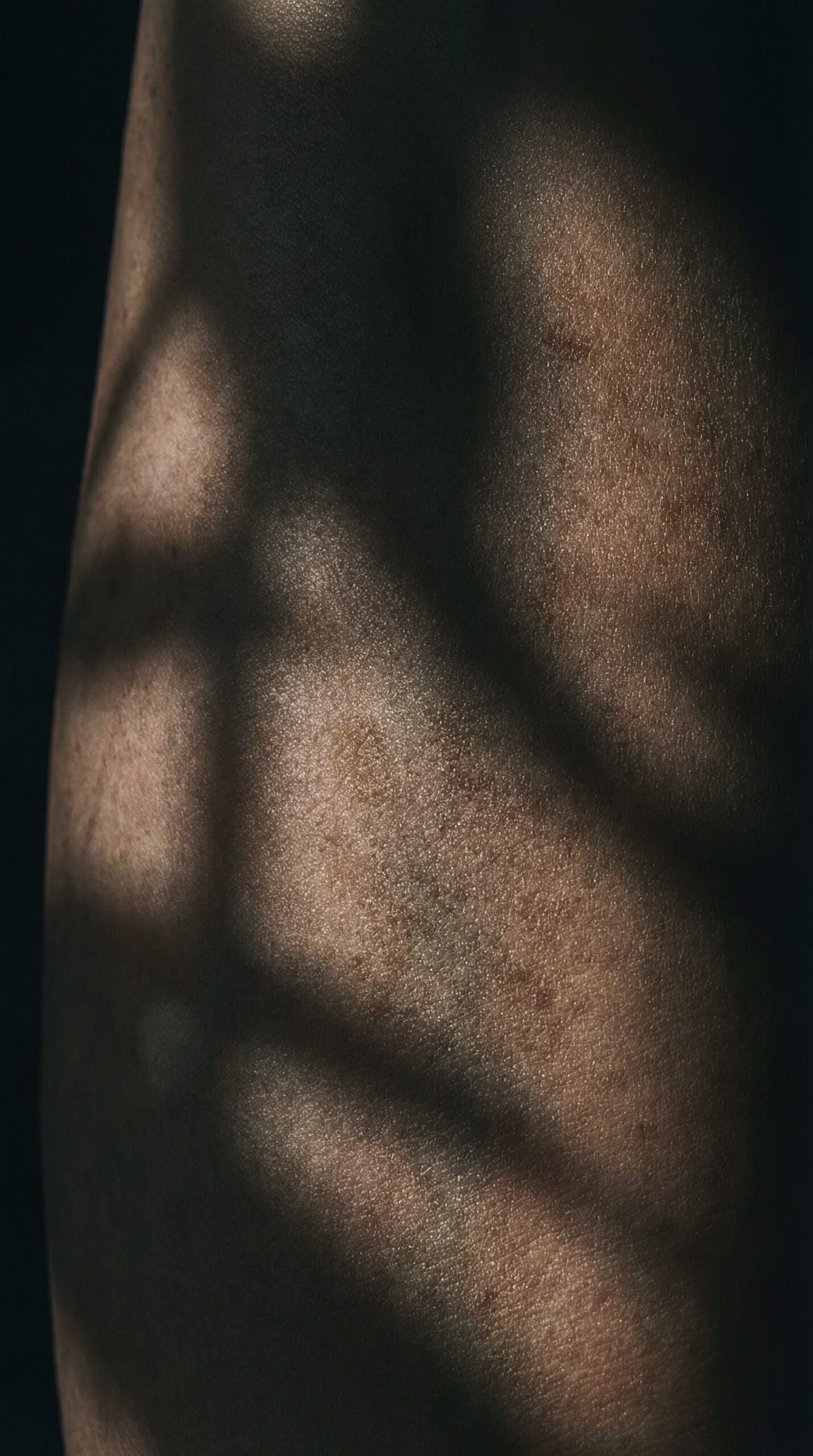 Genital Bölge Neden Kararır?