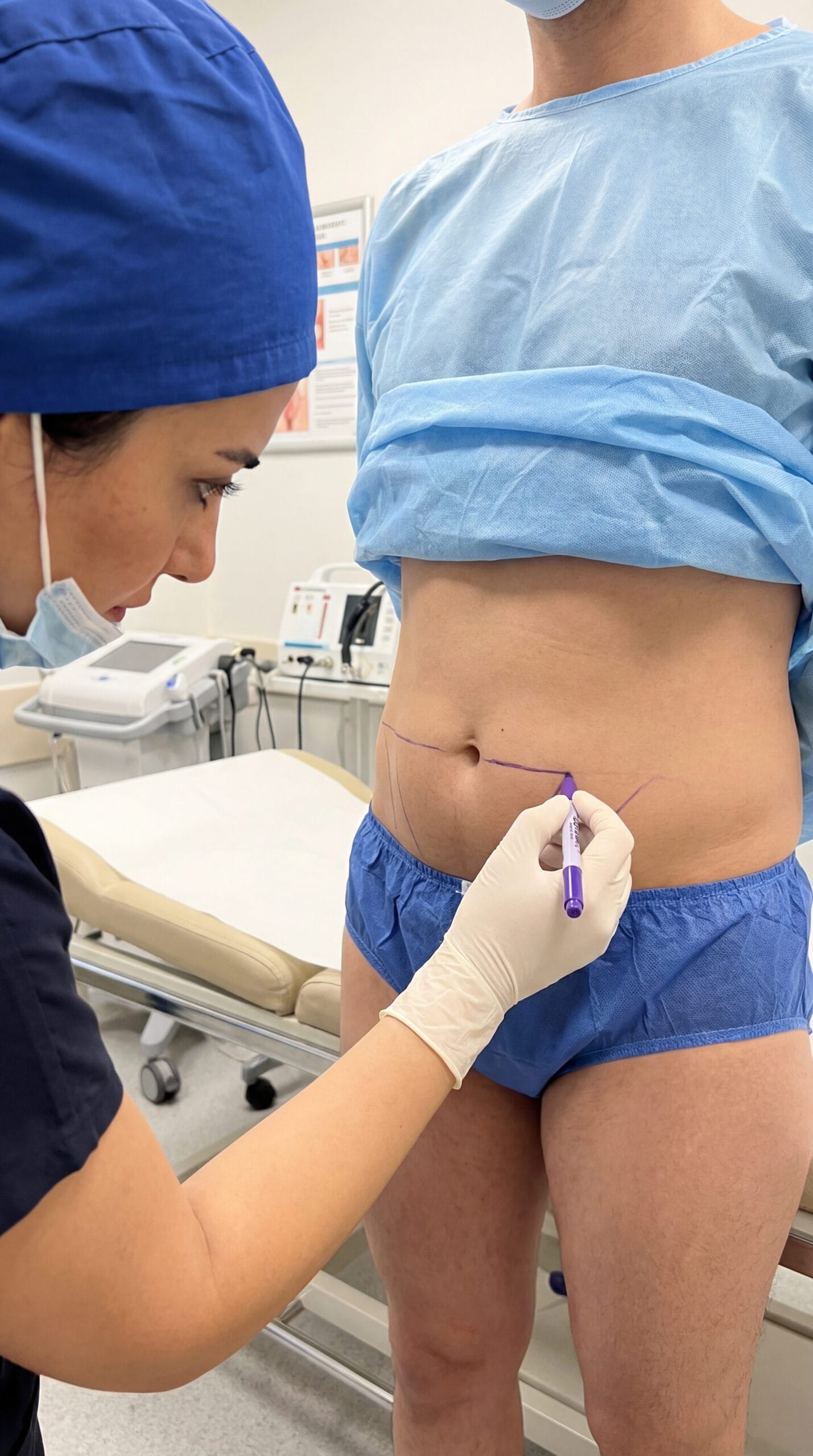 Tedavi Yöntemleri: Liposuction ve Mons Pubis Germe